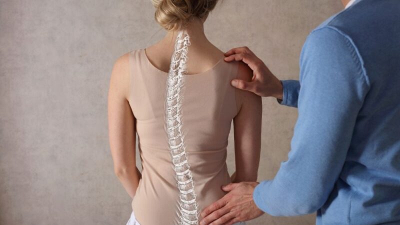 Ngủ dậy bị đau lưng là triệu chứng của vẹo cột sống