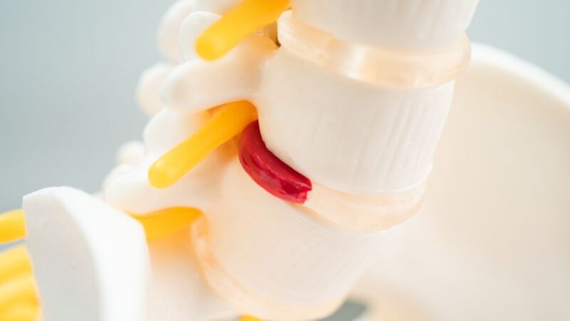 Ngủ dậy bị đau lưng là triệu chứng của đau cơ xơ hoá